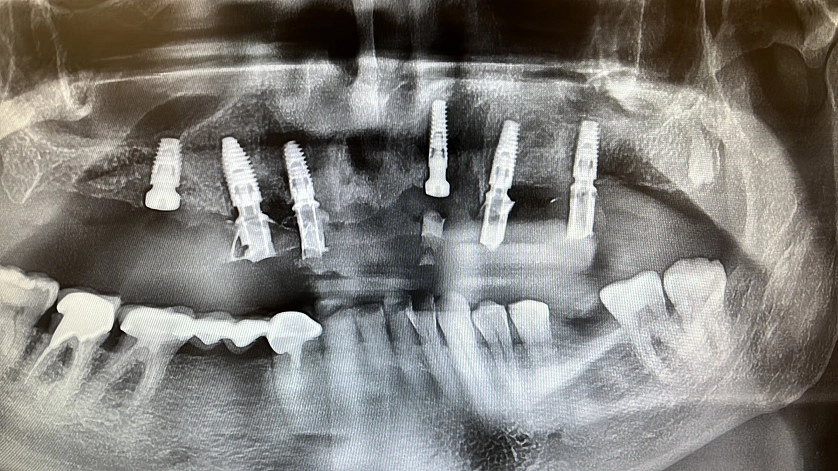 Práce v portfoliu - Allon6