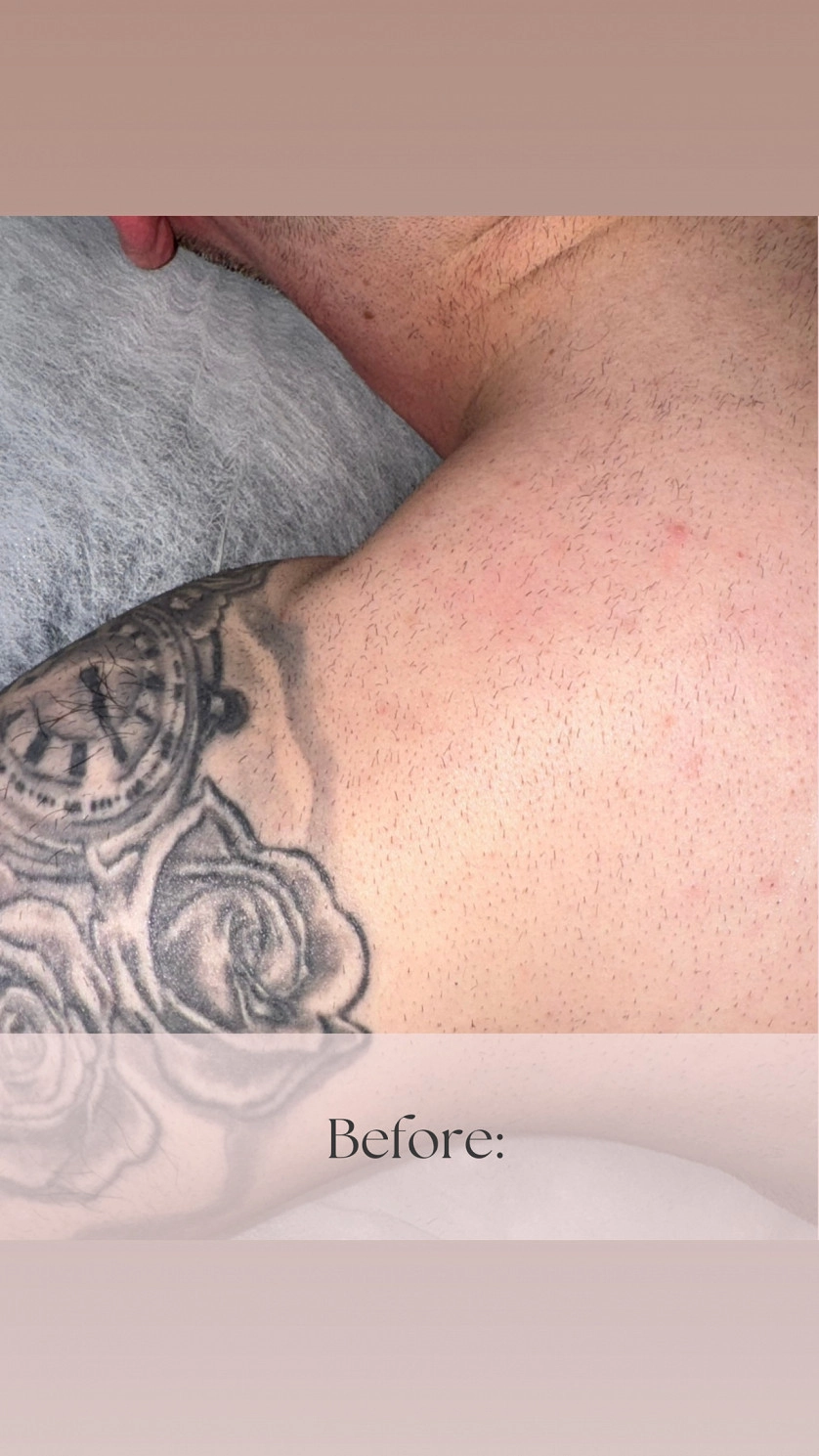 Práce v portfoliu - Лазерная Эпиляция - fotografie 4